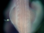 EMAGE:24831