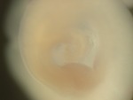 EMAGE:24836