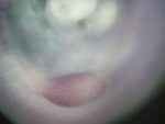EMAGE:24961