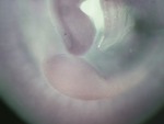EMAGE:24961