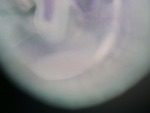 EMAGE:24971
