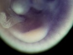 EMAGE:24986