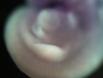 EMAGE:25025