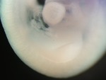 EMAGE:25076