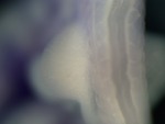 EMAGE:25109