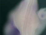 EMAGE:25179