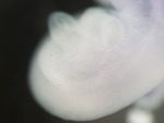 EMAGE:25413