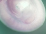 EMAGE:25442