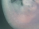 EMAGE:25522