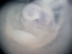 EMAGE:25537