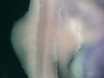 EMAGE:25660