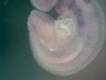 EMAGE:25677