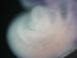 EMAGE:25752