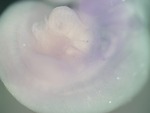 EMAGE:25945