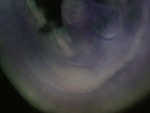 EMAGE:25985
