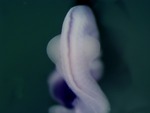 EMAGE:26035