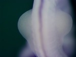EMAGE:26035
