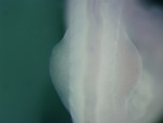 EMAGE:26043