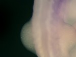 EMAGE:26059