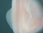 EMAGE:26092