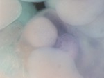 EMAGE:26178