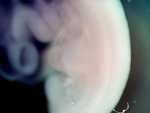 EMAGE:26204