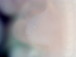 EMAGE:26204
