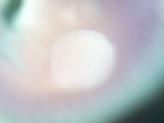 EMAGE:26204