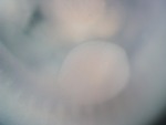 EMAGE:26207