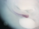 EMAGE:26207