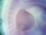 EMAGE:26220