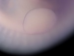 EMAGE:26276