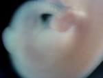 EMAGE:26278