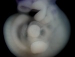 EMAGE:26278