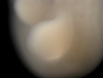 EMAGE:26278
