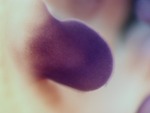 EMAGE:26308