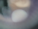 EMAGE:26337