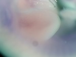EMAGE:26346