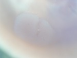 EMAGE:26378