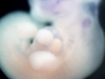 EMAGE:26386