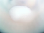 EMAGE:26386