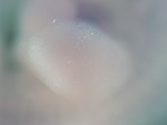 EMAGE:26443