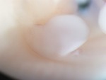 EMAGE:26497