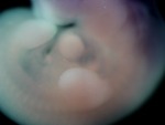 EMAGE:26509