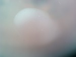 EMAGE:26509