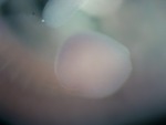 EMAGE:26524