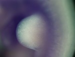 EMAGE:26562