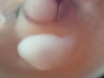 EMAGE:26562