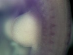 EMAGE:26565
