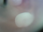 EMAGE:26577